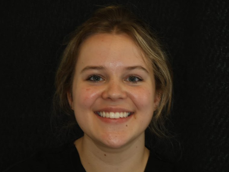 Chelsy Gent, Qualified Dental Nurse at Cheshire Dental Centre