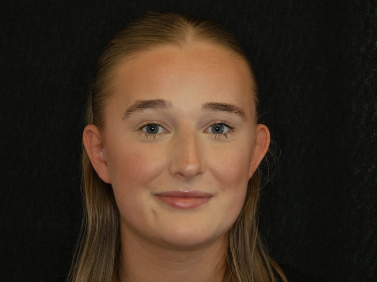 Ebony Kershaw, Dental Nurse at Cheshire Dental Centre